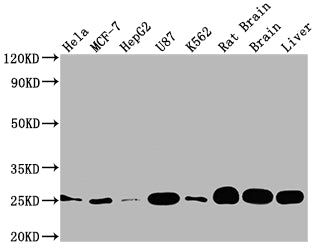 Western Blot; Positive WB detected in: Hela whole cell lysate, MCF-7 whole cell lysate, HepG2 whole cell lysate, U87 whole cell lysate, K562 whole cell lysate, Rat brain tissue, Brain tissue, Liver tissue; All lanes: SOD2 antibody at 1:2000; Secondary; Goat polyclonal to rabbit IgG at 1/50000 dilution; Predicted band size: 25, 21, 19, 20 kDa; Observed band size: 25 kDa