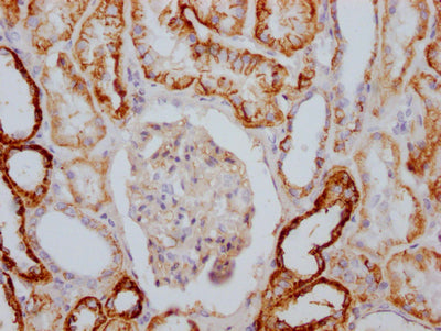 IHC image of RAC07754 diluted at 1:100 and staining in paraffin-embedded human kidney tissue performed on a Leica BondTM system. After dewaxing and hydration, antigen retrieval was mediated by high pressure in a citrate buffer (pH 6.0). Section was blocked with 10% normal goat serum 30min at RT. Then primary antibody (1% BSA) was incubated at 4? overnight. The primary is detected by a Goat anti-rabbit IgG polymer labeled by HRP and visualized using 0.05% DAB.