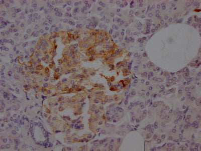 IHC image of RAC07755 diluted at 1:100 and staining in paraffin-embedded human pancreatic tissue performed on a Leica BondTM system. After dewaxing and hydration, antigen retrieval was mediated by high pressure in a citrate buffer (pH 6.0). Section was blocked with 10% normal goat serum 30min at RT. Then primary antibody (1% BSA) was incubated at 4? overnight. The primary is detected by a Goat anti-rabbit IgG polymer labeled by HRP and visualized using 0.05% DAB.