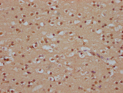 IHC image of RAC07757 diluted at 1:100 and staining in paraffin-embedded human brain tissue performed on a Leica BondTM system. After dewaxing and hydration, antigen retrieval was mediated by high pressure in a citrate buffer (pH 6.0). Section was blocked with 10% normal goat serum 30min at RT. Then primary antibody (1% BSA) was incubated at 4? overnight. The primary is detected by a Goat anti-rabbit IgG polymer labeled by HRP and visualized using 0.05% DAB.