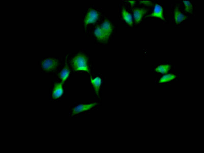 Immunofluorescence staining of Hela Cells with RAC07757 at 1:50, counter-stained with DAPI. The cells were fixed in 4% formaldehyde, permeated by 0.2% TritonX-100, and blocked in 10% normal Goat Serum. The cells were then incubated with the antibody overnight at 4?. Nuclear DNA was labeled in blue with DAPI. The secondary antibody was FITC-conjugated AffiniPure Goat Anti-Rabbit IgG (H+L).
