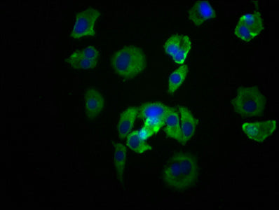 Immunofluorescence staining of MCF-7 cells with RAC07759 at 1:39, counter-stained with DAPI. The cells were fixed in 4% formaldehyde, permeabilized using 0.2% Triton X-100 and blocked in 10% normal Goat Serum. The cells were then incubated with the antibody overnight at 4?. The secondary antibody was Alexa Fluor 488-congugated AffiniPure Goat Anti-Rabbit IgG (H+L).