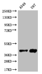Western Blot; Positive WB detected in: A549 whole cell lysate, U87 whole cell lysate; All lanes: SRR antibody at 1:1000; Secondary; Goat polyclonal to rabbit IgG at 1/50000 dilution; Predicted band size: 37 kDa; Observed band size: 37 kDa