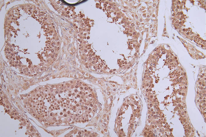IHC image of RAC07761 diluted at 1:50 and staining in paraffin-embedded human testis tissue performed on a Leica BondTM system. After dewaxing and hydration, antigen retrieval was mediated by high pressure in a citrate buffer (pH 6.0). Section was blocked with 10% normal goat serum 30min at RT. Then primary antibody (1% BSA) was incubated at 4Â°C overnight. The primary is detected by a Goat anti-rabbit polymer IgG labeled by HRP and visualized using 0.40% DAB.