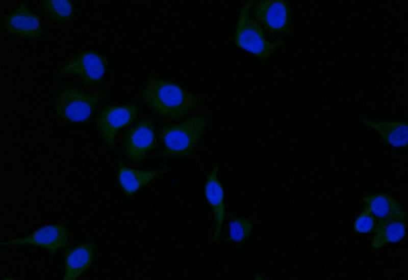 Immunofluorescence staining of Hela with RAC07761 at 1:25, counter-stained with DAPI. The cells were fixed in 4% formaldehyde and blocked in 10% normal Goat Serum. The cells were then incubated with the antibody overnight at 4Â°C. The secondary antibody was Alexa Fluor 508-congugated AffiniPure Goat Anti-Rabbit IgG(H+L).