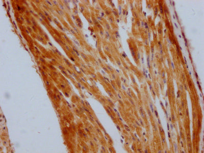 IHC image of RAC07763 diluted at 1:100 and staining in paraffin-embedded human heart tissue performed on a Leica BondTM system. After dewaxing and hydration, antigen retrieval was mediated by high pressure in a citrate buffer (pH 6.0). Section was blocked with 10% normal goat serum 30min at RT. Then primary antibody (1% BSA) was incubated at 4? overnight. The primary is detected by a Goat anti-rabbit IgG polymer labeled by HRP and visualized using 0.05% DAB.