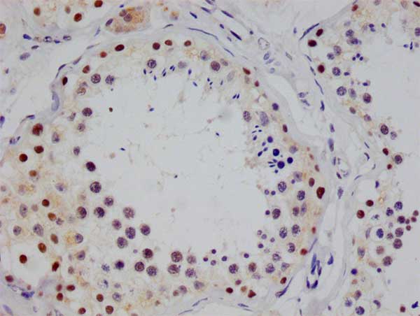 IHC image of RAC07765 diluted at 1:100 and staining in paraffin-embedded human testis tissue performed on a Leica BondTM system. After dewaxing and hydration, antigen retrieval was mediated by high pressure in a citrate buffer (pH 6.0). Section was blocked with 10% normal goat serum 30min at RT. Then primary antibody (1% BSA) was incubated at 4Â°C overnight. The primary is detected by a Goat anti-rabbit polymer IgG labeled by HRP and visualized using 0.05% DAB.