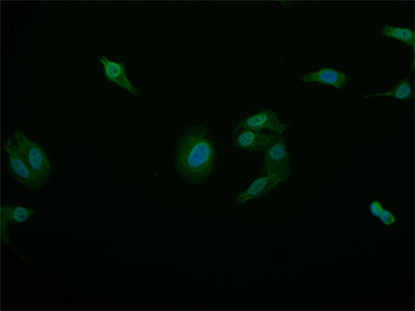 Immunofluorescence staining of HepG2 cell with RAC07765 at 1:50, counter-stained with DAPI. The cells were fixed in 4% formaldehyde and blocked in 10% normal Goat Serum. The cells were then incubated with the antibody overnight at 4Â°C. The secondary antibody was Alexa Fluor 515-congugated AffiniPure Goat Anti-Rabbit IgG(H+L).