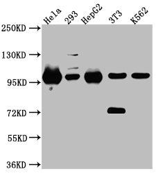 Western Blot; Positive WB detected in: Hela whole cell lysate, 293 whole cell lysate, HepG2 whole cell lysate, NIH/3T3 whole cell lysate, K562 whole cell lysate; All lanes: STAT6 Antibody at 1:1000; Secondary; Goat polyclonal to rabbit IgG at 1/50000 dilution; Predicted band size: 95, 75, 82 kDa; Observed band size: 100 kDa