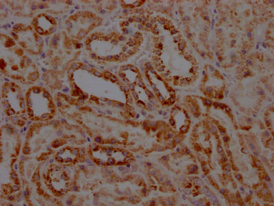 IHC image of RAC07766 diluted at 1:100 and staining in paraffin-embedded human kidney tissue performed on a Leica BondTM system. After dewaxing and hydration, antigen retrieval was mediated by high pressure in a citrate buffer (pH 6.0). Section was blocked with 10% normal goat serum 30min at RT. Then primary antibody (1% BSA) was incubated at 4? overnight. The primary is detected by a Goat anti-rabbit IgG polymer labeled by HRP and visualized using 0.05% DAB.