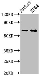 Western Blot; Positive WB detected in: Jurkat whole cell lysate, K562 whole cell lysate; All lanes: STIP1 antibody at 0.9ug/ml; Secondary; Goat polyclonal to rabbit IgG at 1/50000 dilution; Predicted band size: 63, 69, 60 KDa; Observed band size: 63 KDa