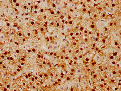 IHC image of RAC07770 diluted at 1:92.5 and staining in paraffin-embedded human adrenal gland tissue performed on a Leica BondTM system. After dewaxing and hydration, antigen retrieval was mediated by high pressure in a citrate buffer (pH 6.0). Section was blocked with 10% normal goat serum 30min at RT. Then primary antibody (1% BSA) was incubated at 4? overnight. The primary is detected by a biotinylated secondary antibody and visualized using an HRP conjugated SP system.
