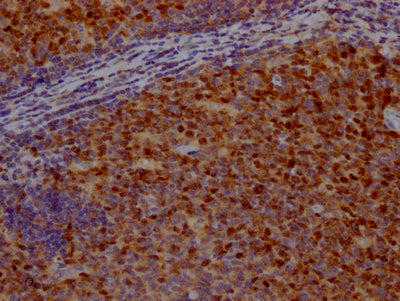 IHC image of RAC07771 diluted at 1:100 and staining in paraffin-embedded human tonsil tissue performed on a Leica BondTM system. After dewaxing and hydration, antigen retrieval was mediated by high pressure in a citrate buffer (pH 6.0). Section was blocked with 10% normal goat serum 30min at RT. Then primary antibody (1% BSA) was incubated at 4? overnight. The primary is detected by a Goat anti-rabbit IgG polymer labeled by HRP and visualized using 0.05% DAB.