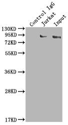 Immunoprecipitating SUZ12 in K562 whole cell lysate; Lane 1: Rabbit control IgG instead of RAC07772 in K562 whole cell lysate.For western blotting,a HRP-conjugated Protein G antibody was used as the secondary antibody (1/2000); Lane 2: RAC07772(2ug)+ K562 whole cell lysate(500ug); Lane 3: K562 whole cell lysate (10ug)