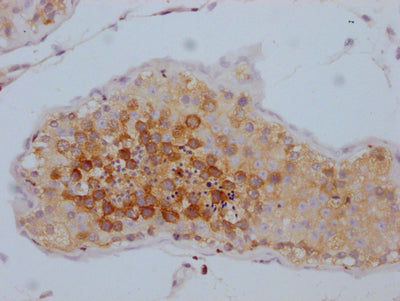 IHC image of RAC07773 diluted at 1:100 and staining in paraffin-embedded human testis tissue performed on a Leica BondTM system. After dewaxing and hydration, antigen retrieval was mediated by high pressure in a citrate buffer (pH 6.0). Section was blocked with 10% normal goat serum 30min at RT. Then primary antibody (1% BSA) was incubated at 4? overnight. The primary is detected by a Goat anti-rabbit IgG polymer labeled by HRP and visualized using 0.05% DAB.