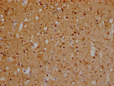 IHC image of RAC07774 diluted at 1:100 and staining in paraffin-embedded human brain tissue performed on a Leica BondTM system. After dewaxing and hydration, antigen retrieval was mediated by high pressure in a citrate buffer (pH 6.0). Section was blocked with 10% normal goat serum 30min at RT. Then primary antibody (1% BSA) was incubated at 4? overnight. The primary is detected by a Goat anti-rabbit IgG polymer labeled by HRP and visualized using 0.05% DAB.