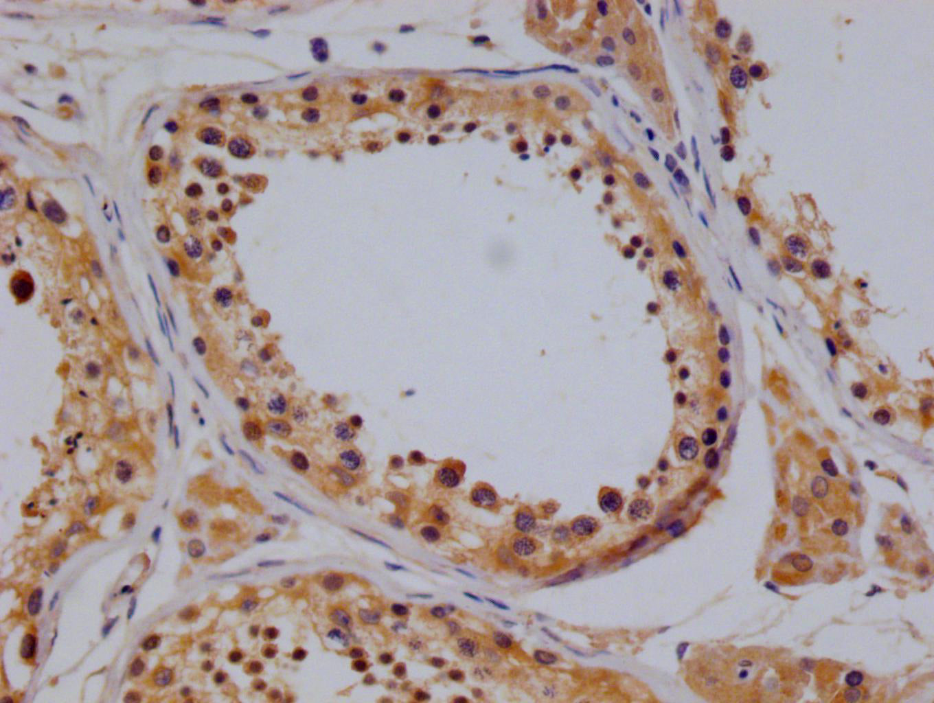 IHC image of RAC07775 diluted at 1:100 and staining in paraffin-embedded human testis tissue performed on a Leica BondTM system. After dewaxing and hydration, antigen retrieval was mediated by high pressure in a citrate buffer (pH 6.0). Section was blocked with 10% normal goat serum 30min at RT. Then primary antibody (1% BSA) was incubated at 4Â°C overnight. The primary is detected by a Goat anti-rabbit polymer IgG labeled by HRP and visualized using 0.05% DAB.