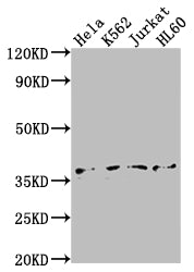Western Blot; Positive WB detected in: Hela whole cell lysate, K562 whole cell lysate, Jurkat whole cell lysate, HL60 whole cell lysate; All lanes: TBP antibody at 1:2000; Secondary; Goat polyclonal to rabbit IgG at 1/50000 dilution; Predicted band size: 38, 36 kDa; Observed band size: 36 kDa