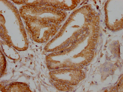 IHC image of RAC07778 diluted at 1:100 and staining in paraffin-embedded human prostate tissue performed on a Leica BondTM system. After dewaxing and hydration, antigen retrieval was mediated by high pressure in a citrate buffer (pH 6.0). Section was blocked with 10% normal goat serum 30min at RT. Then primary antibody (1% BSA) was incubated at 4? overnight. The primary is detected by a Goat anti-rabbit IgG polymer labeled by HRP and visualized using 0.05% DAB.