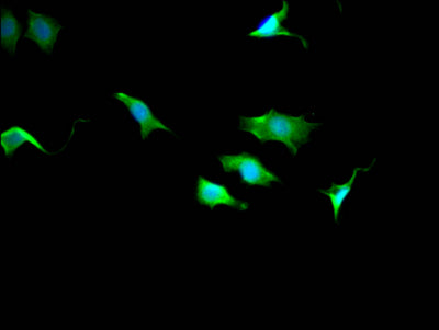 Immunofluorescence staining of SY5Y Cells with RAC07778 at 1:50, counter-stained with DAPI. The cells were fixed in 4% formaldehyde, permeated by 0.2% TritonX-100, and blocked in 10% normal Goat Serum. The cells were then incubated with the antibody overnight at 4?. Nuclear DNA was labeled in blue with DAPI. The secondary antibody was FITC-conjugated AffiniPure Goat Anti-Rabbit IgG (H+L).