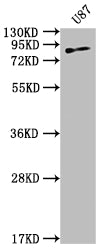 Western Blot; Positive WB detected in: U87 whole cell lysate; All lanes: TGM2 antibody at 1:2000; Secondary; Goat polyclonal to rabbit IgG at 1/50000 dilution; Predicted band size: 78, 62, 39 kDa; Observed band size: 78 kDa
