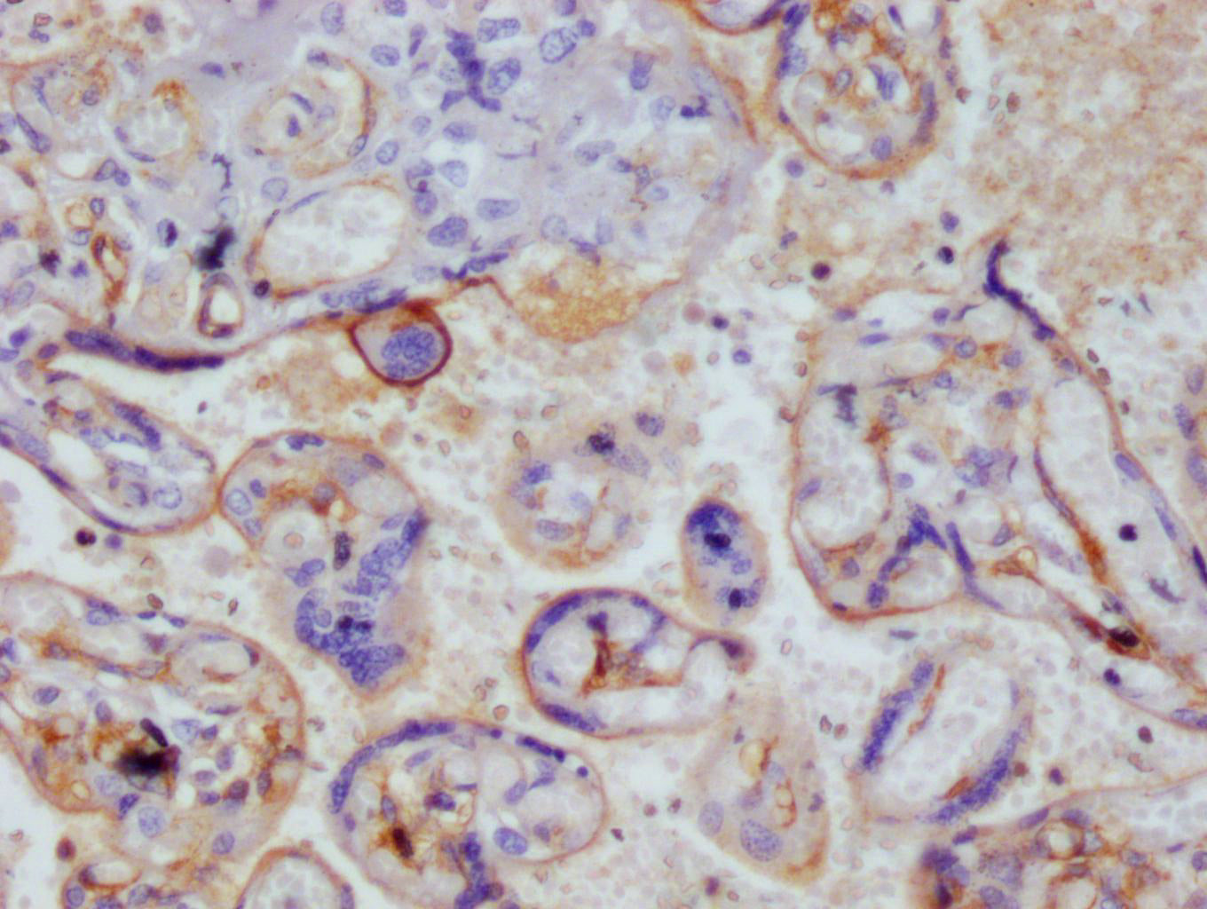 IHC image of RAC07781 diluted at 1:100 and staining in paraffin-embedded human placenta tissue performed on a Leica BondTM system. After dewaxing and hydration, antigen retrieval was mediated by high pressure in a citrate buffer (pH 6.0). Section was blocked with 10% normal goat serum 30min at RT. Then primary antibody (1% BSA) was incubated at 4Â°C overnight. The primary is detected by a Goat anti-rabbit polymer IgG labeled by HRP and visualized using 0.05% DAB.