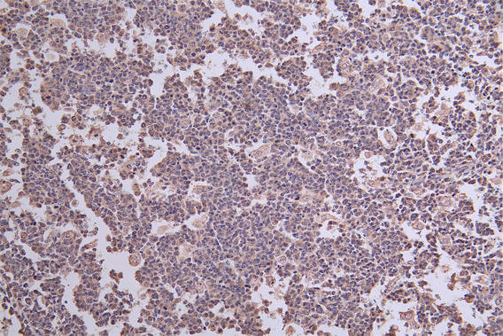 IHC image of RAC07782 diluted at 1:50 and staining in paraffin-embedded human tonsil tissue performed on a Leica BondTM system. After dewaxing and hydration, antigen retrieval was mediated by high pressure in a citrate buffer (pH 6.0). Section was blocked with 10% normal goat serum 30min at RT. Then primary antibody (1% BSA) was incubated at 4Â°C overnight. The primary is detected by a Goat anti-rabbit polymer IgG labeled by HRP and visualized using 0.30% DAB.