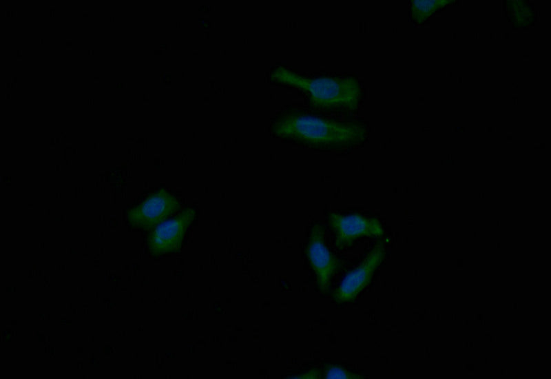 Immunofluorescence staining of HepG2 with RAC07782 at 1:40, counter-stained with DAPI. The cells were fixed in 4% formaldehyde and blocked in 10% normal Goat Serum. The cells were then incubated with the antibody overnight at 4Â°C. The secondary antibody was Alexa Fluor 503-congugated AffiniPure Goat Anti-Rabbit IgG(H+L).