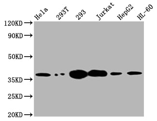 Western Blot; Positive WB detected in: Hela whole cell lysate, 293T whole cell lysate, 293 whole cell lysate, Jurkat whole cell lysate, HepG2 whole cell lysate, HL-60 whole cell lysate; All lanes: Thymidylate Synthase antibody at 1:2000; Secondary; Goat polyclonal to rabbit IgG at 1/50000 dilution; Predicted band size: 36, 32, 27 kDa; Observed band size: 36 kDa