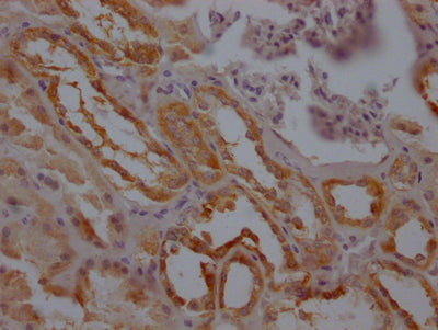 IHC image of RAC07785 diluted at 1:100 and staining in paraffin-embedded human kidney tissue performed on a Leica BondTM system. After dewaxing and hydration, antigen retrieval was mediated by high pressure in a citrate buffer (pH 6.0). Section was blocked with 10% normal goat serum 30min at RT. Then primary antibody (1% BSA) was incubated at 4? overnight. The primary is detected by a Goat anti-rabbit IgG polymer labeled by HRP and visualized using 0.05% DAB.