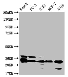Western Blot; Positive WB detected in: HepG2 whole cell lysate, PC-3 whole cell lysate, U251 whole cell lysate, MCF-7 whole cell lysate, A549 whole cell lysate; All lanes: TMEM192 antibody at 1:1000; Secondary; Goat polyclonal to rabbit IgG at 1/50000 dilution; Predicted band size: 31 kDa; Observed band size: 31 kDa