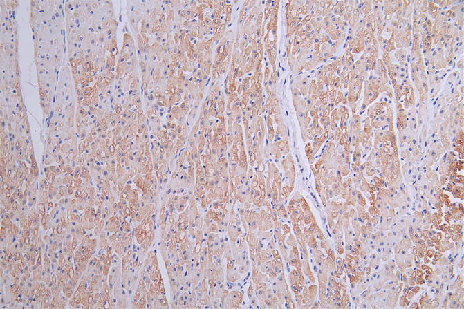 IHC image of RAC07791 diluted at 1:50 and staining in paraffin-embedded human heart tissue performed on a Leica BondTM system. After dewaxing and hydration, antigen retrieval was mediated by high pressure in a citrate buffer (pH 6.0). Section was blocked with 10% normal goat serum 30min at RT. Then primary antibody (1% BSA) was incubated at 4Â°C overnight. The primary is detected by a Goat anti-rabbit polymer IgG labeled by HRP and visualized using 0.16% DAB.