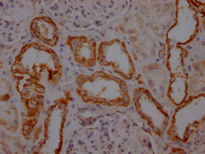 IHC image of RAC07792 diluted at 1:100 and staining in paraffin-embedded human kidney tissue performed on a Leica BondTM system. After dewaxing and hydration, antigen retrieval was mediated by high pressure in a citrate buffer (pH 6.0). Section was blocked with 10% normal goat serum 30min at RT. Then primary antibody (1% BSA) was incubated at 4? overnight. The primary is detected by a Goat anti-rabbit IgG polymer labeled by HRP and visualized using 0.05% DAB.