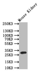 Western Blot; Positive WB detected in: Mouse Kidney tissue lysate,; All lanes: Mast Cell Tryptase antibody at 1:1000; Secondary; Goat polyclonal to rabbit IgG at 1/50000 dilution; Predicted band size: 30 kDa; Observed band size: 30 kDa