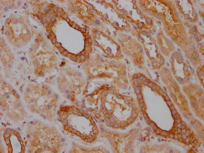 IHC image of RAC07796 diluted at 1:100 and staining in paraffin-embedded human kidney tissue performed on a Leica BondTM system. After dewaxing and hydration, antigen retrieval was mediated by high pressure in a citrate buffer (pH 6.0). Section was blocked with 10% normal goat serum 30min at RT. Then primary antibody (1% BSA) was incubated at 4? overnight. The primary is detected by a Goat anti-rabbit IgG polymer labeled by HRP and visualized using 0.05% DAB.