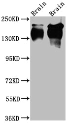 Western Blot; Positive WB detected in: Rat Brain whole cell lysate, Mouse Brain whole cell lysate; All lanes: TrkA Antibody at 1:1000; Secondary; Goat polyclonal to rabbit IgG at 1/50000 dilution; Predicted band size: 88, 87, 84, 78 kDa; Observed band size: 145 kDa