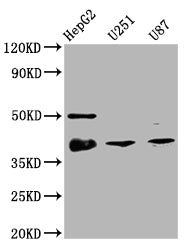 Western Blot; Positive WB detected in: HepG2 whole cell lysate, U251 whole cell lysate, U87 whole cell lysate; All lanes: TTF1 antibody at 1:2000; Secondary; Goat polyclonal to rabbit IgG at 1/50000 dilution; Predicted band size: 39 kDa; Observed band size: 39 kDa