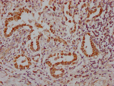 IHC image of RAC07801 diluted at 1:100 and staining in paraffin-embedded human lung tissue performed on a Leica BondTM system. After dewaxing and hydration, antigen retrieval was mediated by high pressure in a citrate buffer (pH 6.0). Section was blocked with 10% normal goat serum 30min at RT. Then primary antibody (1% BSA) was incubated at 4? overnight. The primary is detected by a Goat anti-rabbit IgG polymer labeled by HRP and visualized using 0.05% DAB.