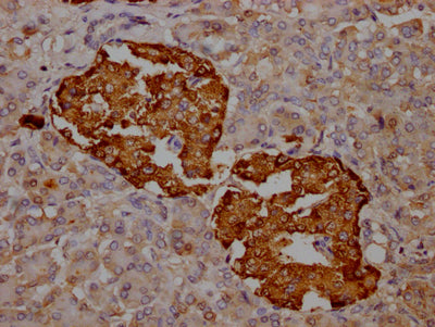 IHC image of RAC07802 diluted at 1:100 and staining in paraffin-embedded human pancreatic tissue performed on a Leica BondTM system. After dewaxing and hydration, antigen retrieval was mediated by high pressure in a citrate buffer (pH 6.0). Section was blocked with 10% normal goat serum 30min at RT. Then primary antibody (1% BSA) was incubated at 4? overnight. The primary is detected by a Goat anti-rabbit IgG polymer labeled by HRP and visualized using 0.05% DAB.