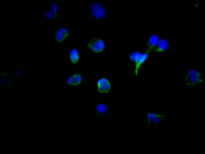 Immunofluorescence staining of MCF7 Cells with RAC07803 at 1:50, counter-stained with DAPI. The cells were fixed in 4% formaldehyde, permeated by 0.2% TritonX-100, and blocked in 10% normal Goat Serum. The cells were then incubated with the antibody overnight at 4?. Nuclear DNA was labeled in blue with DAPI. The secondary antibody was FITC-conjugated AffiniPure Goat Anti-Rabbit IgG (H+L).