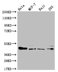 Western Blot; Positive WB detected in: Hela whole cell lysate, MCF-7 whole cell lysate, Raji whole cell lysate, HEK293 whole cell lysate; All lanes: ULBP1 antibody at 1:1000; Secondary; Goat polyclonal to rabbit IgG at 1/50000 dilution; Predicted band size: 28 kDa; Observed band size: 36-50 kDa