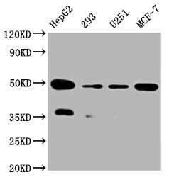 Western Blot; Positive WB detected in:HepG2 whole cell lysate, 293 whole cell lysate, U251 whole cell lysate, MCF-7 whole cell lysate; All lanes: UQCRC2 antibody at 1:2000; Secondary; Goat polyclonal to rabbit IgG at 1/50000 dilution; Predicted band size: 49 kDa; Observed band size: 49 kDa
