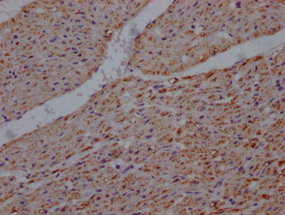 IHC image of RAC07806 diluted at 1:100 and staining in paraffin-embedded human heart tissue performed on a Leica BondTM system. After dewaxing and hydration, antigen retrieval was mediated by high pressure in a citrate buffer (pH 6.0). Section was blocked with 10% normal goat serum 30min at RT. Then primary antibody (1% BSA) was incubated at 4? overnight. The primary is detected by a Goat anti-rabbit IgG polymer labeled by HRP and visualized using 0.05% DAB.