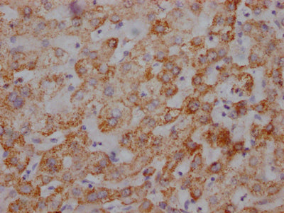IHC image of RAC07806 diluted at 1:100 and staining in paraffin-embedded human liver tissue performed on a Leica BondTM system. After dewaxing and hydration, antigen retrieval was mediated by high pressure in a citrate buffer (pH 6.0). Section was blocked with 10% normal goat serum 30min at RT. Then primary antibody (1% BSA) was incubated at 4? overnight. The primary is detected by a Goat anti-rabbit IgG polymer labeled by HRP and visualized using 0.05% DAB.