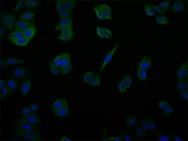 Immunofluorescence staining of PC-3 cell with RAC07808 at 1:50, counter-stained with DAPI. The cells were fixed in 4% formaldehyde and blocked in 10% normal Goat Serum. The cells were then incubated with the antibody overnight at 4Â°C. The secondary antibody was Alexa Fluor 517-congugated AffiniPure Goat Anti-Rabbit IgG(H+L).