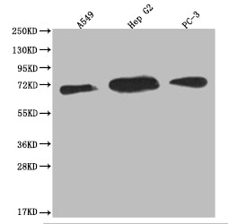 Western Blot; Positive WB detected in: A549 whole cell lysate, HepG2 whole cell lysate, PC3 whole cell lysate; All lanes: USP22 antibody at 1:2000; Secondary; Goat polyclonal to rabbit IgG at 1/50000 dilution; Predicted band size: 60, 59 kDa; Observed band size: 55-72 kDa