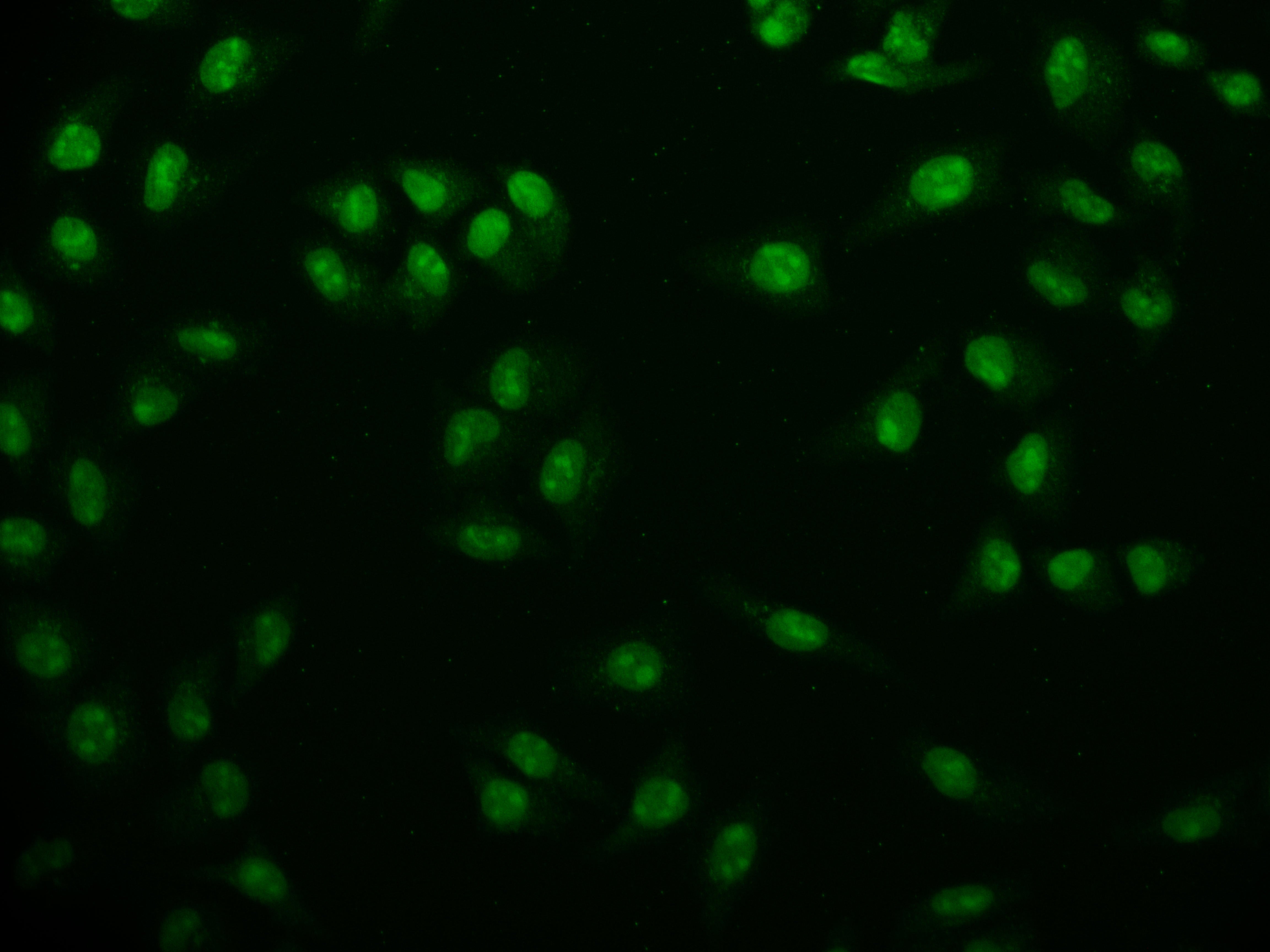 Immunofluorescence staining of Hela cell with RAC07809 at 1:50, counter-stained with DAPI. The cells were fixed in 4% formaldehyde and blocked in 10% normal Goat Serum. The cells were then incubated with the antibody overnight at 4Â°C. The secondary antibody was Alexa Fluor 507-congugated AffiniPure Goat Anti-Rabbit IgG(H+L).
