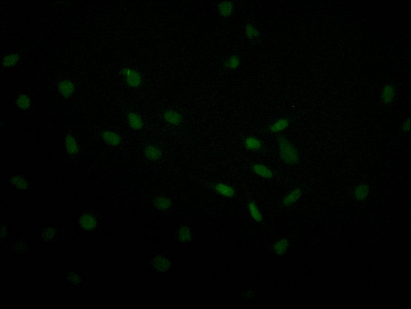 Immunofluorescence staining of MCF-7 with RAC07810 at 1:30, counter-stained with DAPI. The cells were fixed in 4% formaldehyde and blocked in 10% normal Goat Serum. The cells were then incubated with the antibody overnight at 4Â°C. The secondary antibody was Alexa Fluor 493-congugated AffiniPure Goat Anti-Rabbit IgG(H+L).