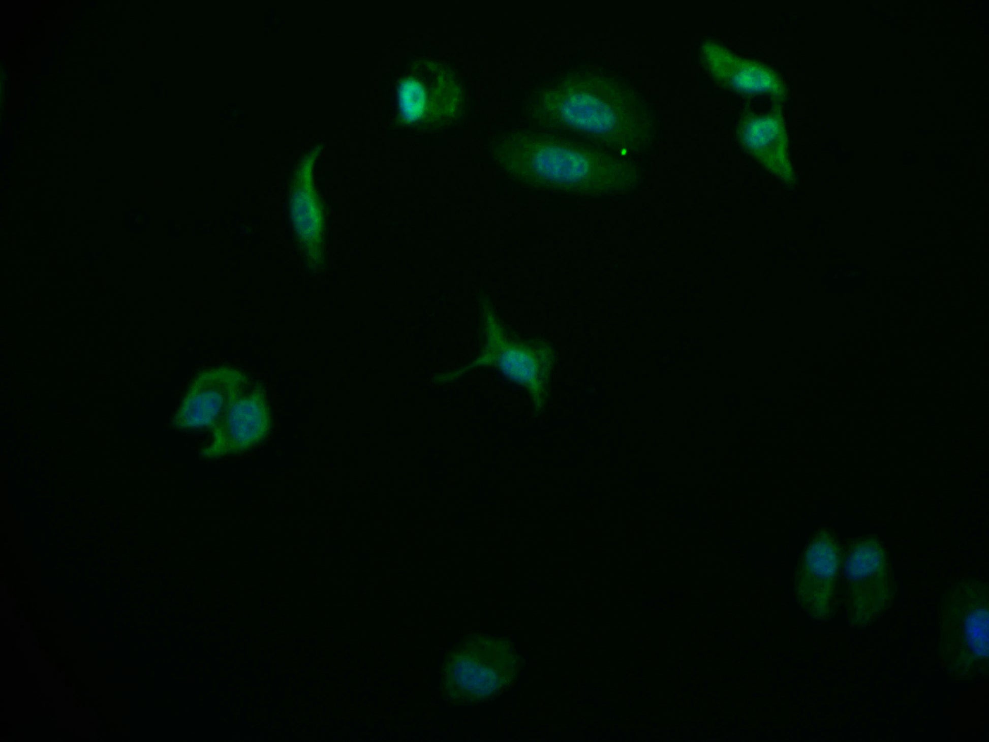 Immunofluorescence staining of HepG2 cell with RAC07811 at 1:50, counter-stained with DAPI. The cells were fixed in 4% formaldehyde and blocked in 10% normal Goat Serum. The cells were then incubated with the antibody overnight at 4Â°C. The secondary antibody was Alexa Fluor 569-congugated AffiniPure Goat Anti-Rabbit IgG(H+L).