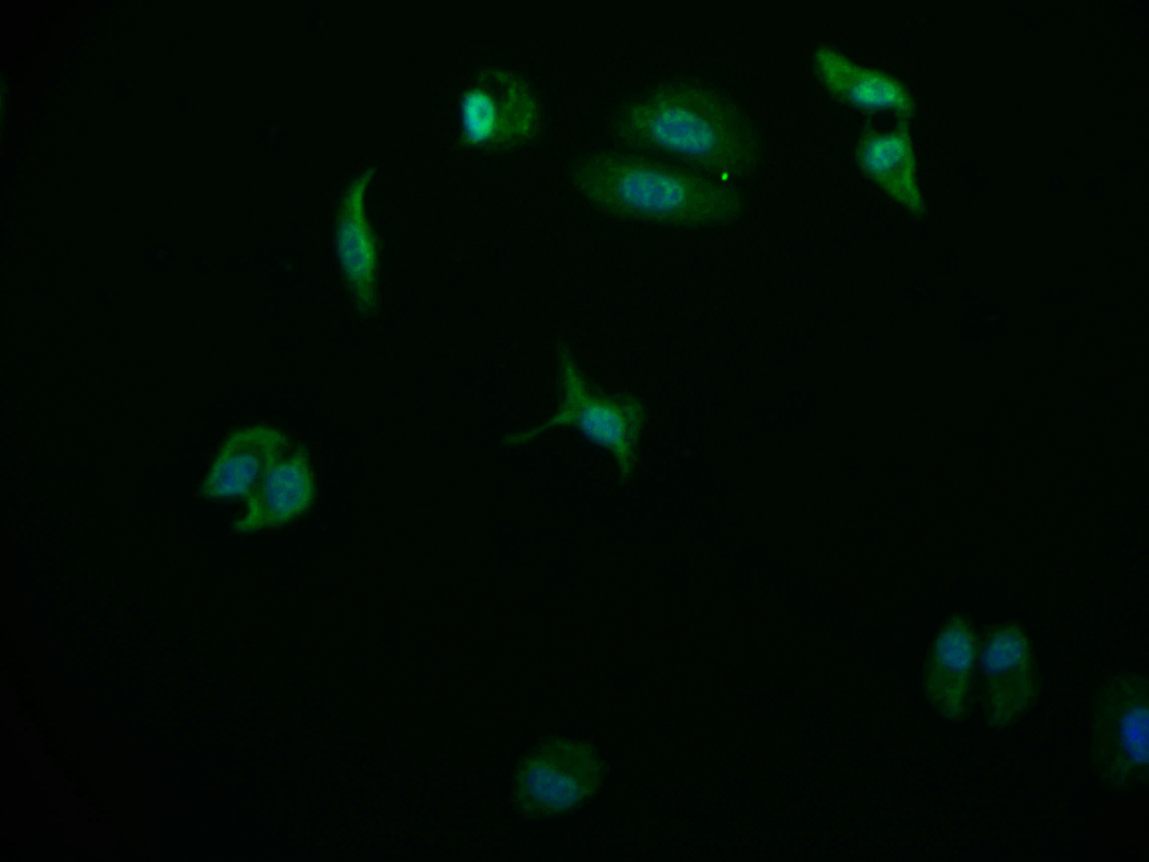 Immunofluorescence staining of HepG2 cell with RAC07811 at 1:50, counter-stained with DAPI. The cells were fixed in 4% formaldehyde and blocked in 10% normal Goat Serum. The cells were then incubated with the antibody overnight at 4Â°C. The secondary antibody was Alexa Fluor 569-congugated AffiniPure Goat Anti-Rabbit IgG(H+L).